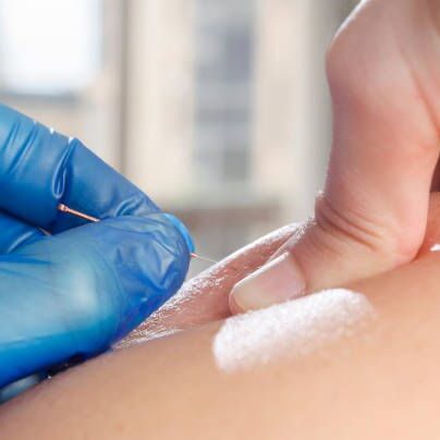needles acupuncture in selangor