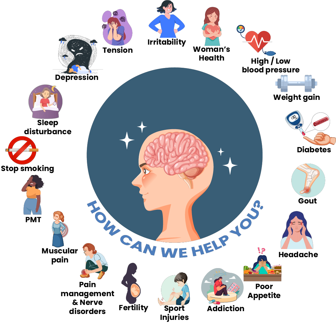 how acupuncture selangor helps